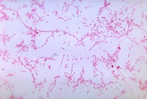 fusobacterium.__v30048871